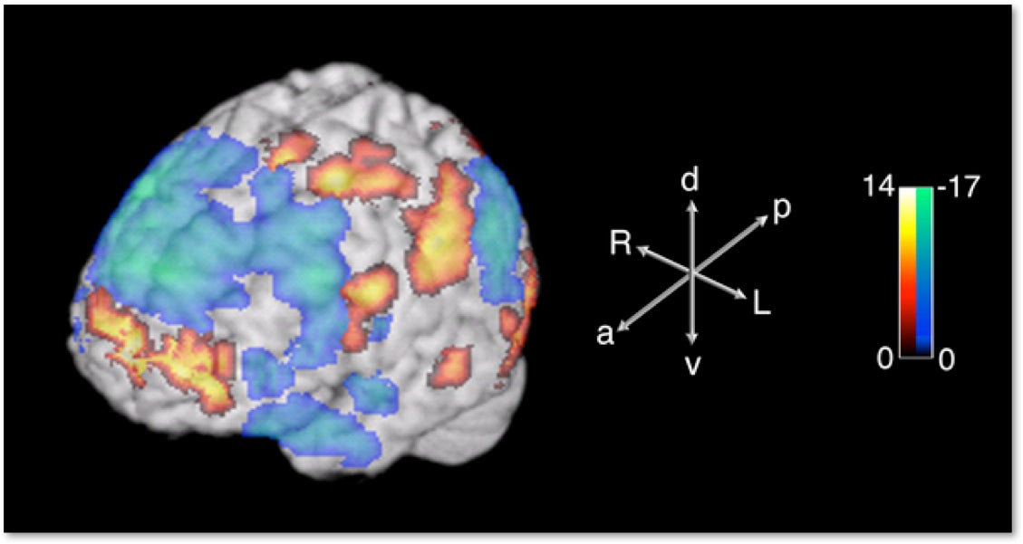 Limb Braun Research Image of Brain Activity