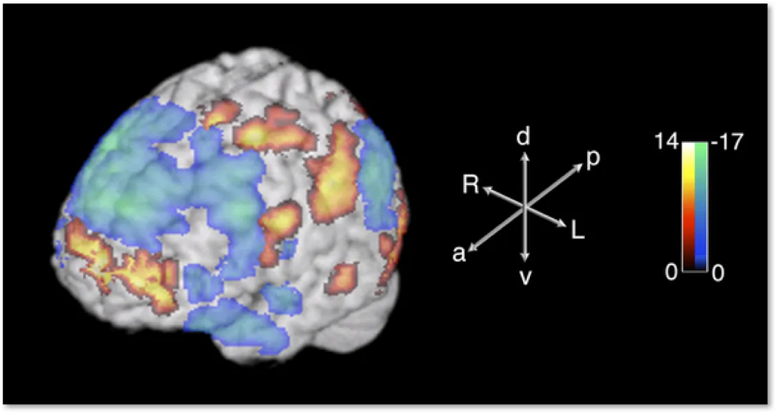 Limb Braun Research Image of Brain Activity