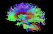 DTI Brain Image